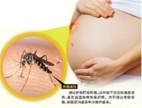 小头症发病的原因