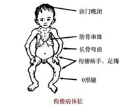 囟门大是什么原因