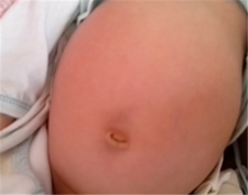新生儿肚子鼓鼓的是怎么回事 宝宝肚子鼓一定是胀气吗3
