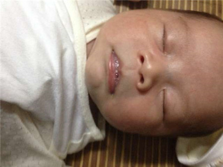 新生儿肺炎严重吗2