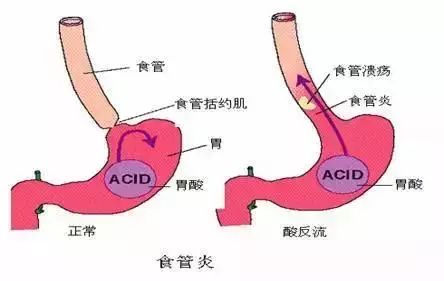 除了哭声，新生宝宝的这些声音爸妈也要了解！