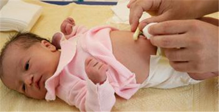 新生儿脐带怎么护理 消毒步骤要牢记