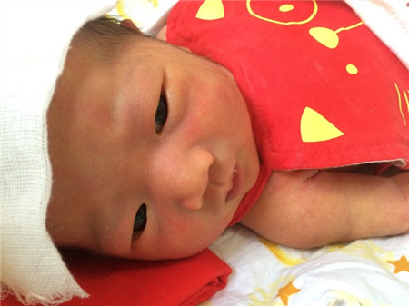 新生儿什么情况下需要补钙2
