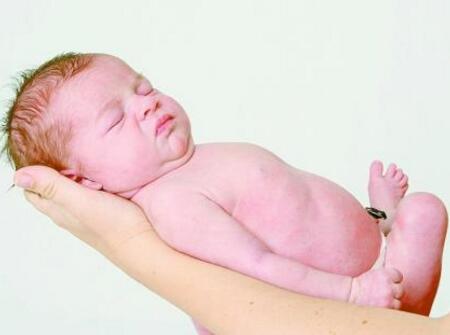 新生儿羊水吸入综合征怎么治疗3