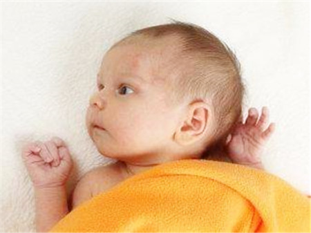 新生儿怕热吗 夏天该如何护理新生儿呢3