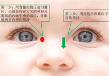 婴儿泪道冲洗最佳时间3