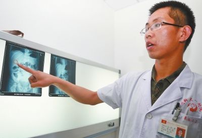 医生在CT片上发现了童童体内的异物