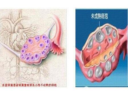两性畸形怎么办2