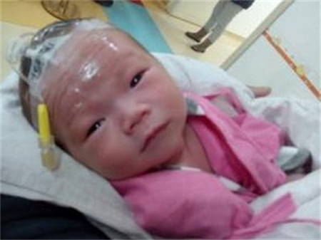 新生儿肺炎会嗜睡吗3