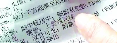 孕妇产检正常却生下兔唇婴儿医院有责任!