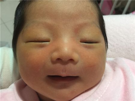 母乳性黄疸要吃药吗3