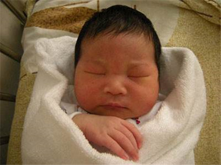 母乳性黄疸可以混合喂养吗2