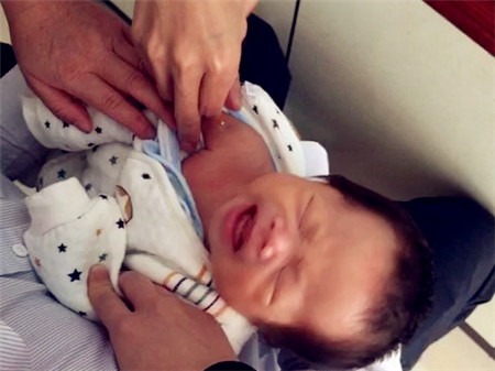 母乳性黄疸可以打疫苗吗4