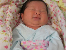 母乳性黄疸需要治疗吗4