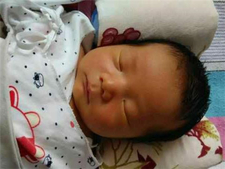 母乳性黄疸的症状4