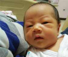 母乳性黄疸的危害4