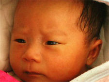 母乳性黄疸照蓝光有用吗1