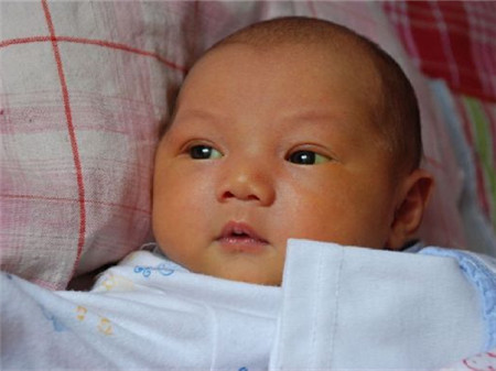 母乳性黄疸照蓝光有用吗4