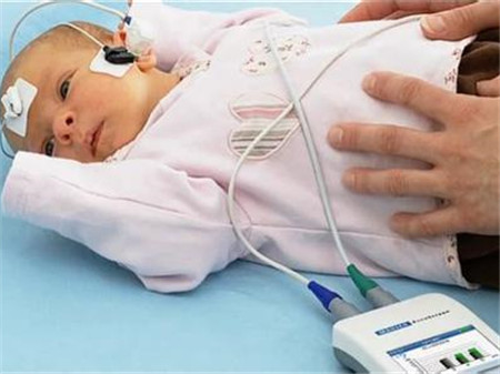 新生儿听力筛查的方法1