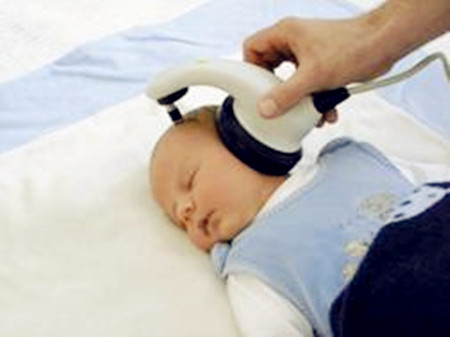新生儿听力筛查的方法3