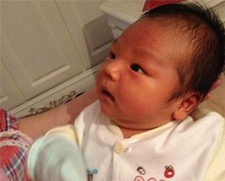 母乳性黄疸是病理性吗3