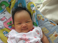 母乳性黄疸容易反复吗1