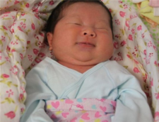 母乳性黄疸会影响智力吗4