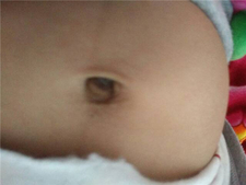 宝宝肚脐里的脏东西能抠吗2