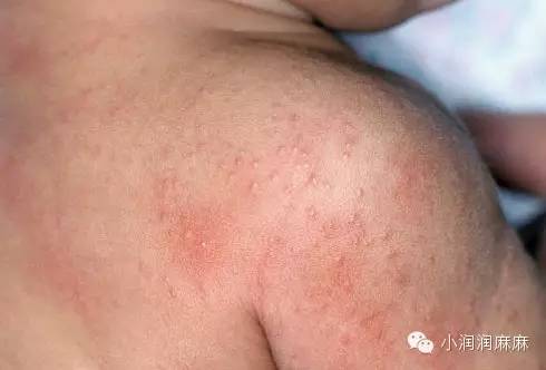 新生儿护理│出生后困扰妈妈的“面子”问题