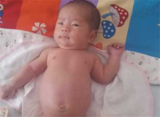 新生儿肚脐消毒多久2