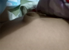 新生儿有脐疝怎么办4