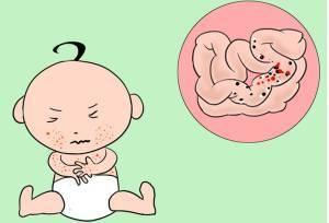 宝宝乳糖不耐受的症状 不同类型具体分析2