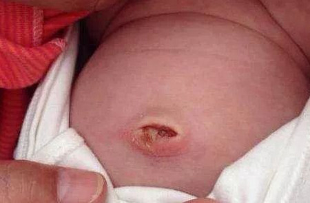照顾新生婴儿，这几个地方不能随便动！