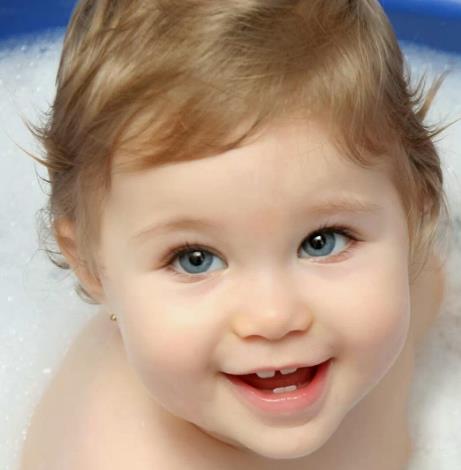 唐氏儿能治好吗