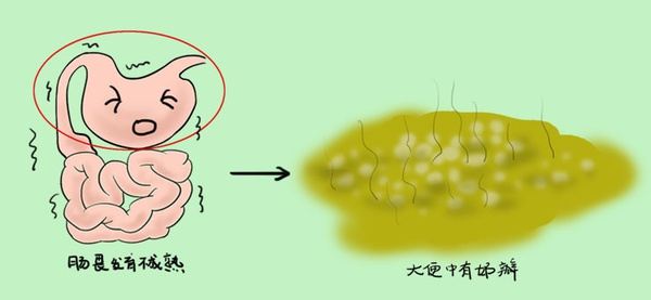 怎么判断新生儿消化不良 护理方法建议2