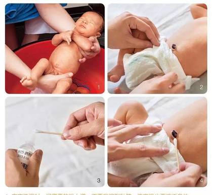 新生儿脐带护理图解：消毒、干燥最重要！