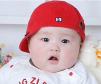 新生儿溶血性黄疸的症状2
