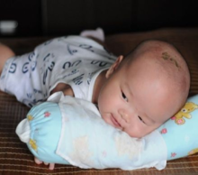 足月新生儿黄疸值多少可出院1