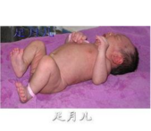 正常足月儿的定义1
