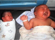 足月新生儿营养不良有哪些表现3