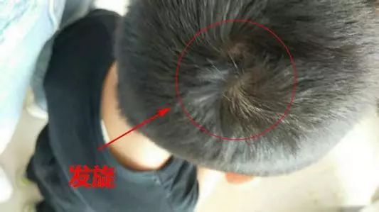宝宝这些身体特征能暗示智商高低吗？别再迷信了！