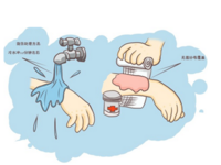 宝宝烫伤要打破伤风吗？