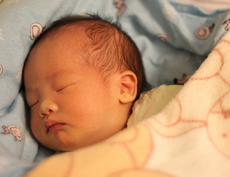 新生儿小头症能治愈吗？