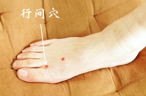 肝火旺艾灸哪里比较好 这些穴位效果好