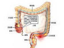 小儿急性阑尾炎的并发症2