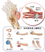 手指关节肿大2