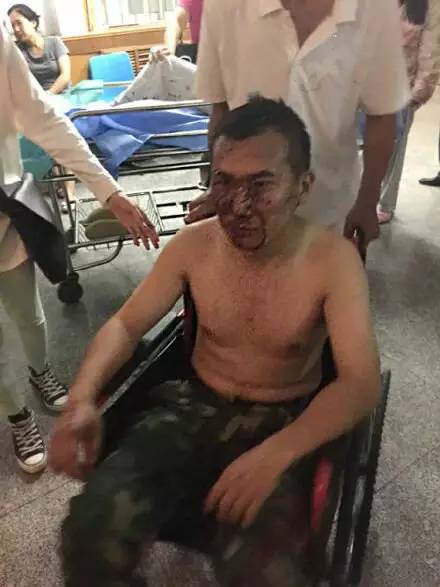 天津塘沽大爆炸