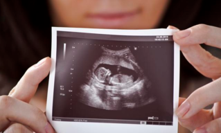 通过孕囊可以推测怀孕时间吗 孕囊计算预产期准吗