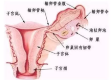 输卵管积水要不要切除 输卵管积水的检查方法