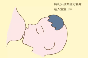 产后乳腺炎可以预防吗 产后乳腺炎预防方法